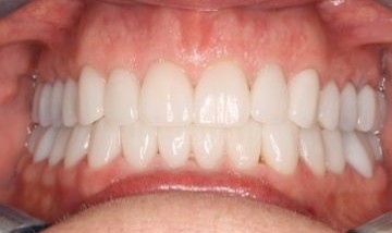 Patient after treatment.