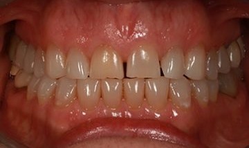 Patient before treatment.